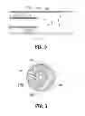 Fig. 04 - OCCLUSION TREATMENT SYSTEM