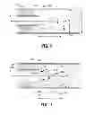 Fig. 07 - OCCLUSION TREATMENT SYSTEM
