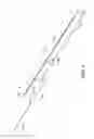 Fig. 05 - Infusion flow guidewire system