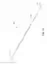 Fig. 13 - Infusion flow guidewire system