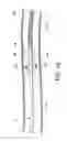 Fig. 17 - Infusion flow guidewire system