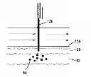 Fig. 01 - Skin puncturing apparatus for use in a non-surgical method for eradication of tattoos