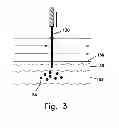 Fig. 04 - Skin puncturing apparatus for use in a non-surgical method for eradication of tattoos