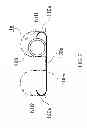 Fig. 04 - NASAL CAVITY INSERTION DEVICE FIXTURE AND NASAL CAVITY INSERSION DEVICE SET INCLUDING THE SAME