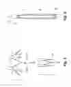 Fig. 06 - EMBOLUS BLOOD CLOT FILTER WITH FLOATING FILTER BASKET