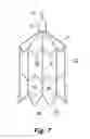 Fig. 07 - EMBOLUS BLOOD CLOT FILTER WITH FLOATING FILTER BASKET