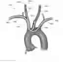 Fig. 01 - EMBOLISM PROTECTION DEVICE