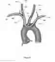 Fig. 07 - EMBOLISM PROTECTION DEVICE