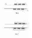 Fig. 02 - Catheter markers