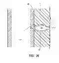 Fig. 12 - Vascular closure device with a plug having a variable expansion rate and method for using the same