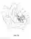 Fig. 12 - Spinous process fixation apparatus