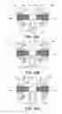 Fig. 15 - Spinous process fixation apparatus