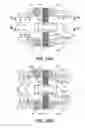 Fig. 16 - Spinous process fixation apparatus