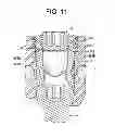 Fig. 10 - Bone anchor assemblies
