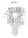 Fig. 16 - Bone anchor assemblies