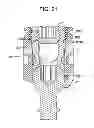 Fig. 19 - Bone anchor assemblies