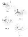 Fig. 04 - Vertebral osteosynthesis equipment