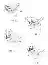 Fig. 05 - Vertebral osteosynthesis equipment