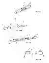 Fig. 06 - Spinal Stabilization Device