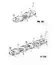 Fig. 09 - Spinal Stabilization Device
