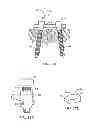 Fig. 14 - Spinal Stabilization Device