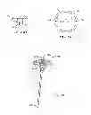 Fig. 15 - Spinal Stabilization Device