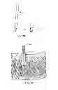 Fig. 20 - Spinal Stabilization Device