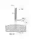 Fig. 22 - Spinal Stabilization Device