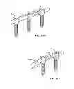 Fig. 28 - Spinal Stabilization Device
