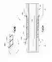 Fig. 43 - Spinal Stabilization Device