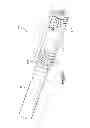 Fig. 46 - Spinal Stabilization Device