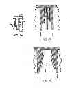 Fig. 04 - Polyaxial screw