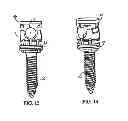 Fig. 08 - Polyaxial screw