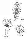Fig. 10 - Polyaxial screw