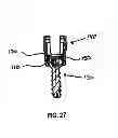 Fig. 14 - Polyaxial screw