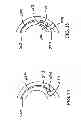 Fig. 21 - Polyaxial screw