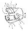 Fig. 44 - Polyaxial screw