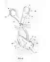 Fig. 06 - Spinal correction system and method