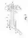 Fig. 03 - Adjustable height arthroplasty plate