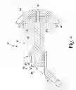 Fig. 05 - Adjustable height arthroplasty plate