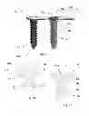 Fig. 02 - Locking screws and plates