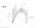 Fig. 06 - Medical fastener