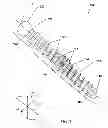 Fig. 03 - Expandable screw and methods of use