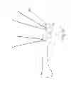 Fig. 09 - SURGICAL LOCATOR