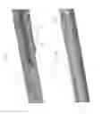 Fig. 07 - Devices and methods for breaking and retaining surgical reduction tabs
