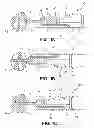 Fig. 02 - Bone fixation tool