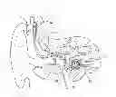 Fig. 01 - COCHLEAR IMPLANT HEARING INSTRUMENT