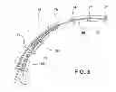 Fig. 04 - COCHLEAR IMPLANT HEARING INSTRUMENT