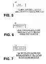 Fig. 05 - Intelligent sync mode for defibrillation