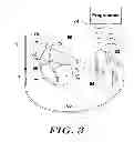 Fig. 04 - Methods and devices for accurately classifying cardiac activity
